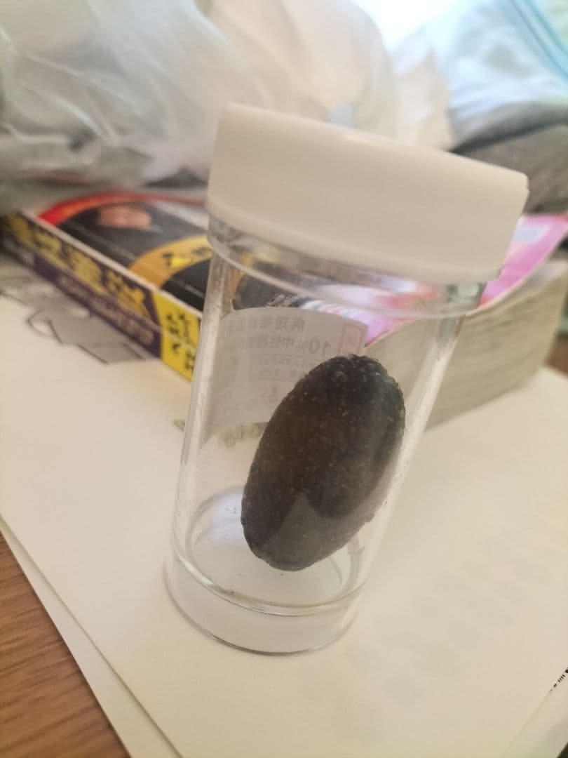 胆のうの中にあった石